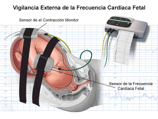 Monitor de latido del corazón del bebé Embarazo, monitor portátil de ritmo  cardíaco fetal Doppler