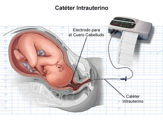 Latido fetal: ¿Cuándo y cómo escuchar el corazón del bebé?