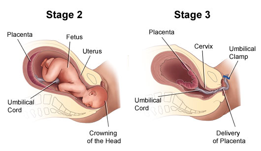 Guide to the Second Stage of Labor and Pushing