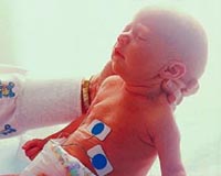 Newborn Medical Exam - Doctor Checking Head Size with a