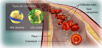 Colesterol en el torrente sanguíneo