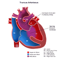 Click Image to Enlarge Anatomy of a heart with truncus arteriosus