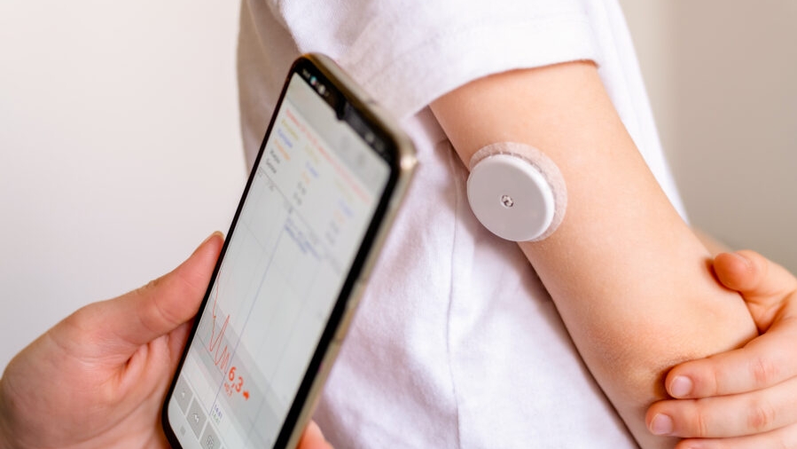 Continuous glucose monitoring device on child